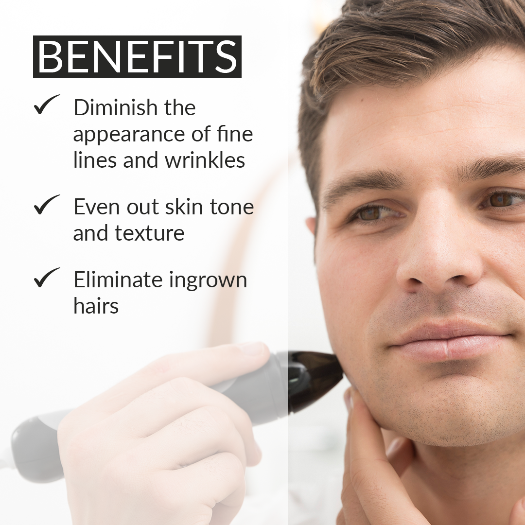 Personal Microderm Man