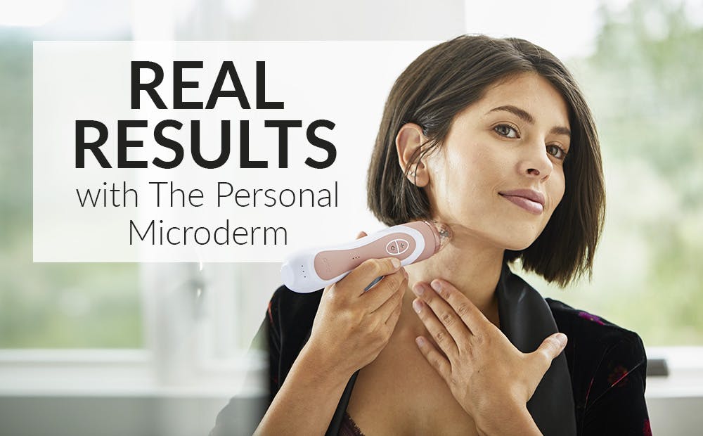 REAL RESULTS With The Personal Microderm