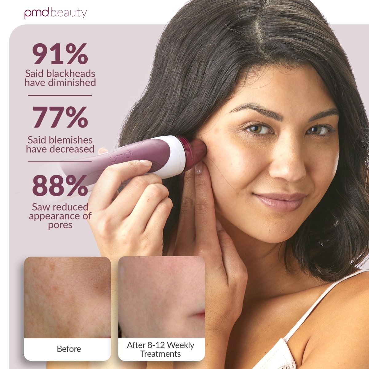 Personal Microderm Pro AU