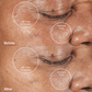 4002-Berry?Before and After Image with Results